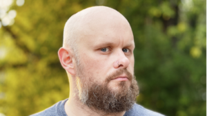 טיפול בהתקרחות